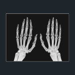 Skeleton Hands Xray Picture Human Anatomy photo Postcard<br><div class="desc">Skeleton Hands Xray Picture Human Anatomy photo</div>