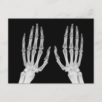 Skeleton Hands Xray Picture Human Anatomy photo