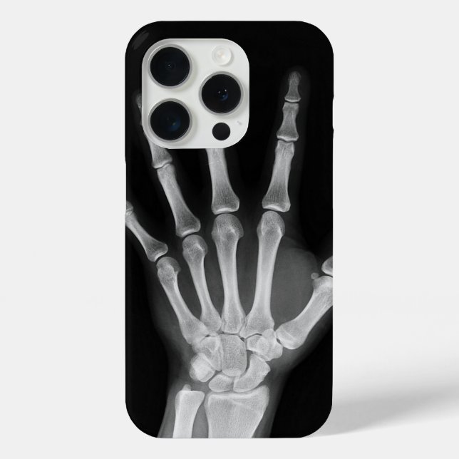 Skeleton iPhone 15 pro cover (Back)