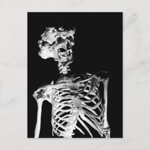 Skeleton Postcard