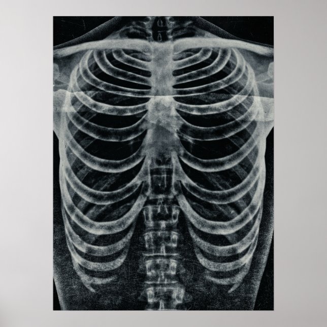 Skeleton Xray Rib Cage Vintage Black White Gothic Poster (Front)
