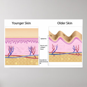 Skin problems print Poster