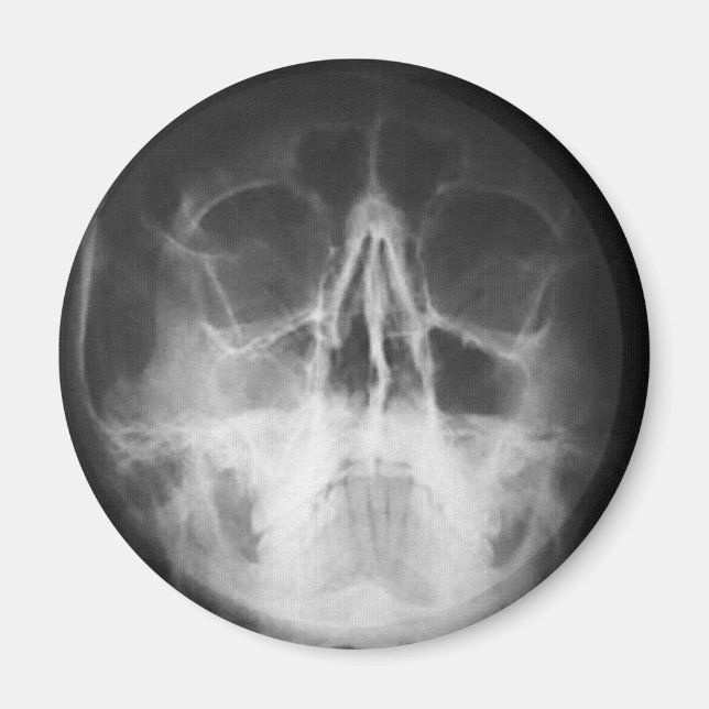 Skully Top Fun Magnet (Front)