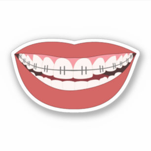 Smile Orthodontic Appliance