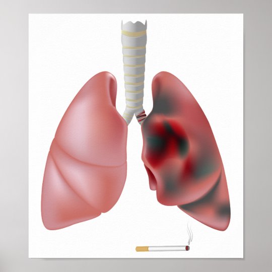 Smoking and lung cancer Poster Zazzle.co.uk