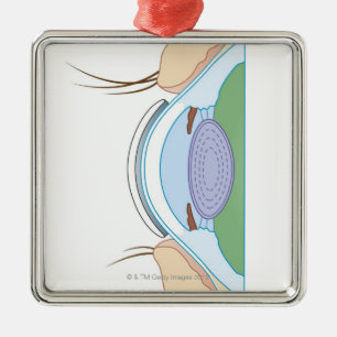 Soft Contact Lens Metal Tree Decoration