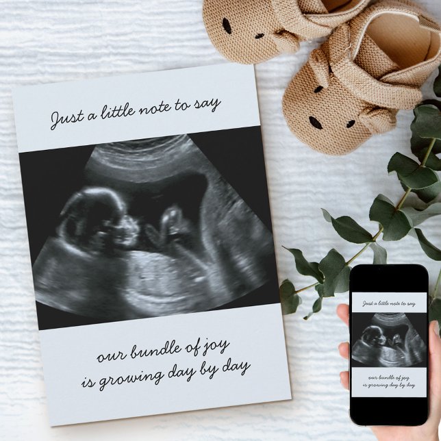 Sonogram Photo Pale Blue Pregnancy Announcement (Creator Uploaded)