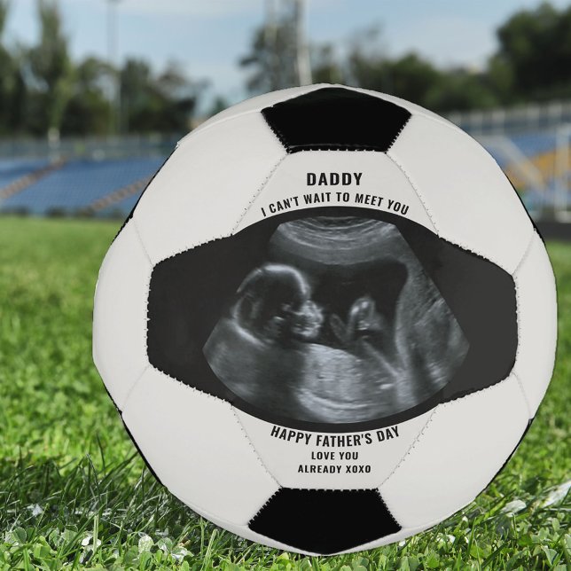 Sonogram Pregnancy Photo Black White Personalised Football (Creator Uploaded)