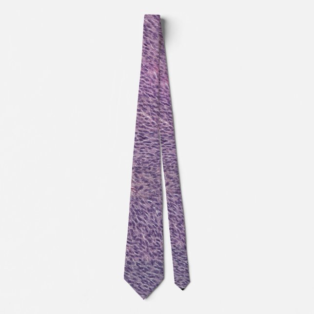 Spindle melanoma necktie (Front)