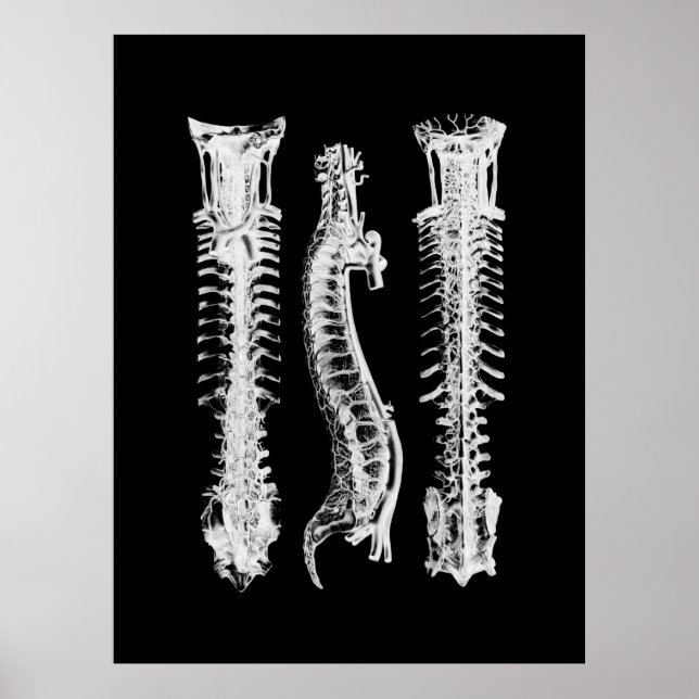 Spine Anatomy Art Poster (Front)