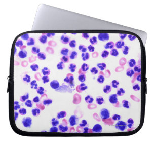 Staph Infection Laptop Sleeve