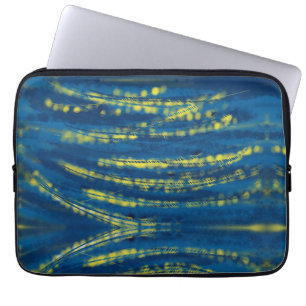 Strings of Gold Laptop Sleeve
