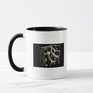 Structure of a bone with osteoporosis mug