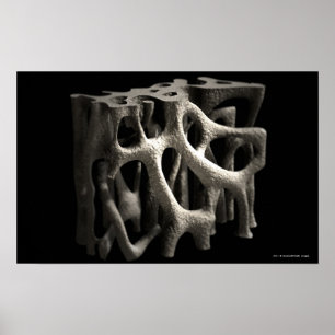 Structure of a bone with osteoporosis poster