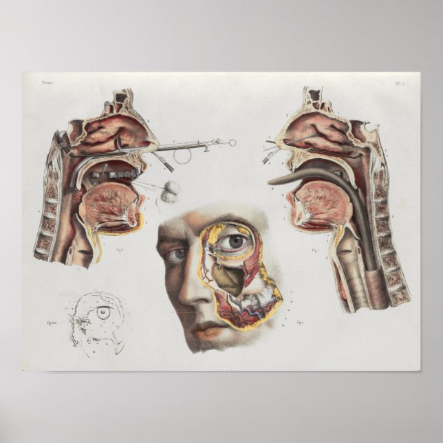 Surgery Medical Technique Vintage Anatomy Print (Front)