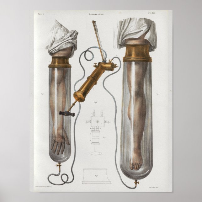 Surgical Medical Instruments Vintage Anatomy Print (Front)