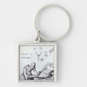 Surgical operation to amputate a leg key ring