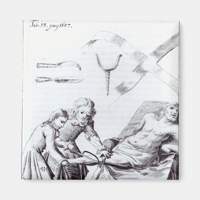 Surgical operation to amputate a leg magnet (Front)