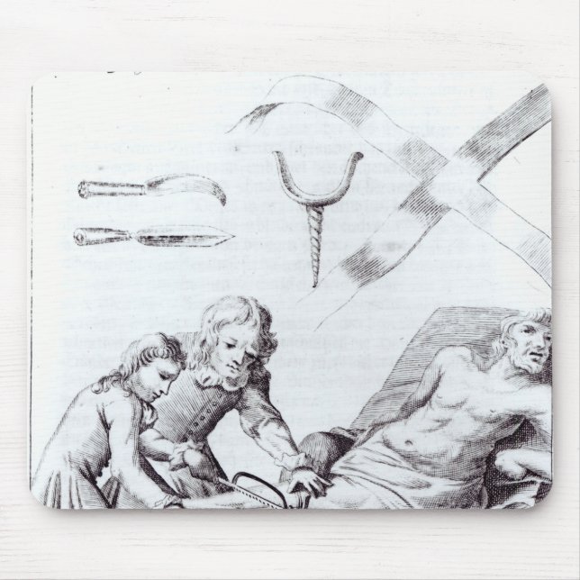 Surgical operation to amputate a leg mouse mat (Front)