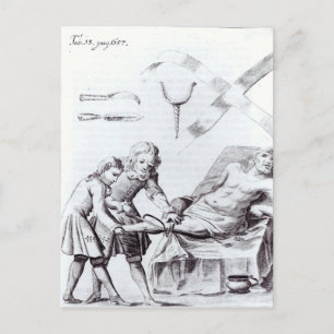 Surgical operation to amputate a leg postcard