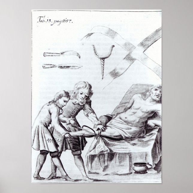 Surgical operation to amputate a leg poster (Front)