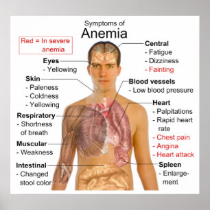 Symptoms Chart of the Blood Disease Anemia