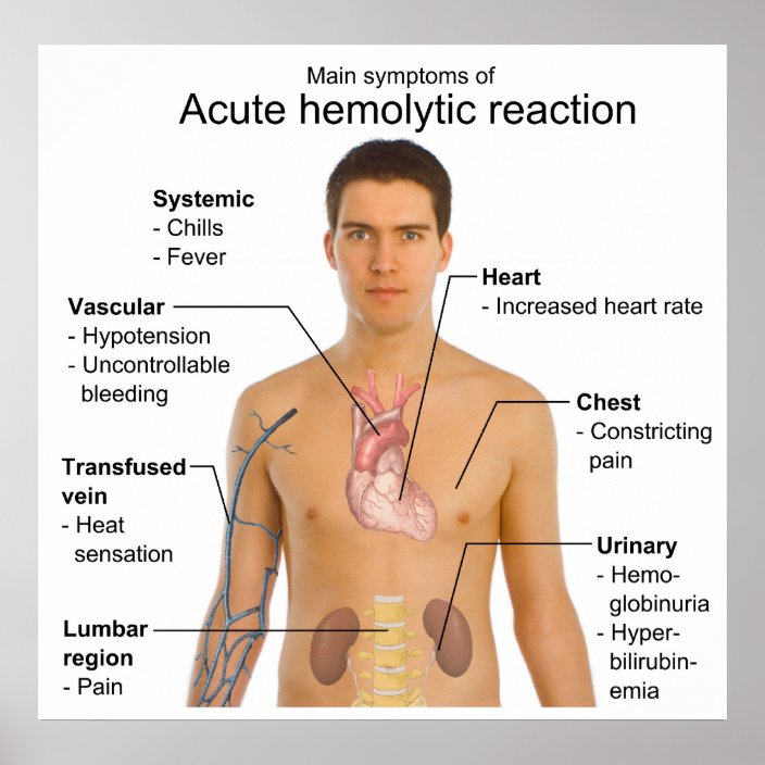 symptoms-of-acute-hemolytic-transfusion-reaction-poster-zazzle-co-uk