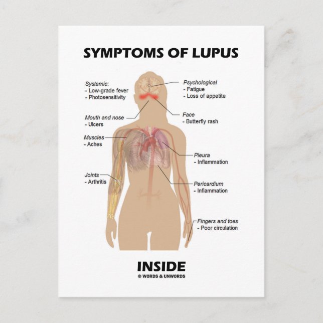 Symptoms Of Lupus Inside (Autoimmune Disorder) Postcard (Front)
