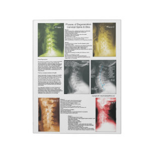 Tear Off Pad Cervical Spinal Degeneration