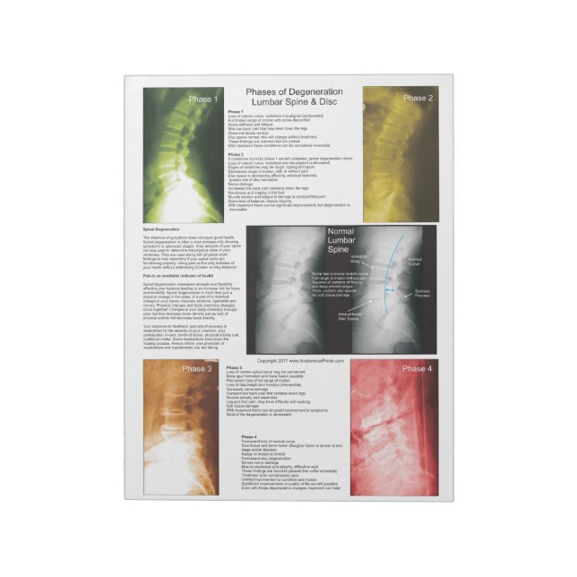 Tear Off Pad Lumbar Spinal Degeneration (Rotated)