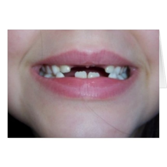 teeth (Front Horizontal)