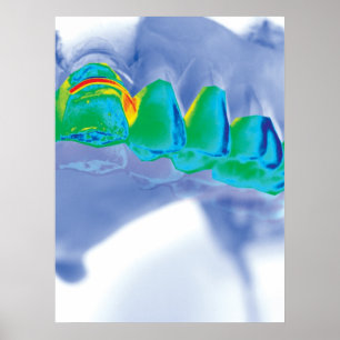 Teeth Design Dentist Orthodontist Poster