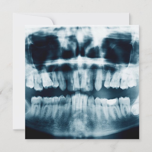 Teeth X-ray (Front)
