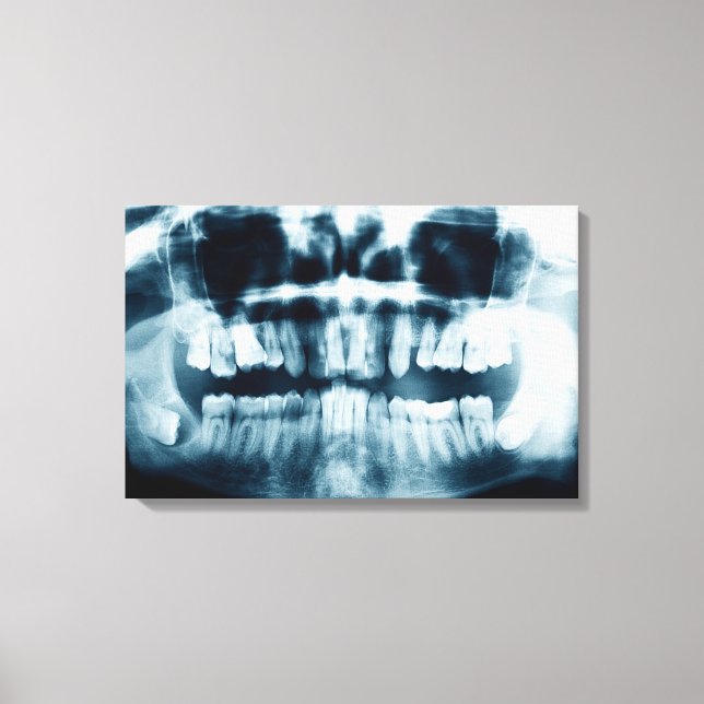 Teeth X-ray Canvas Print (Front)
