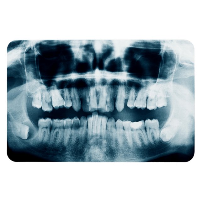 Teeth X-ray Magnet (Horizontal)
