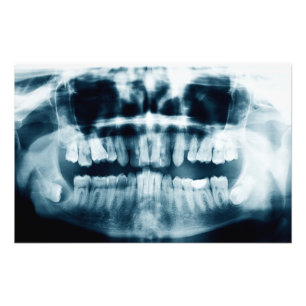 Teeth X-ray Photo Print