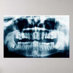 Teeth X-ray Poster