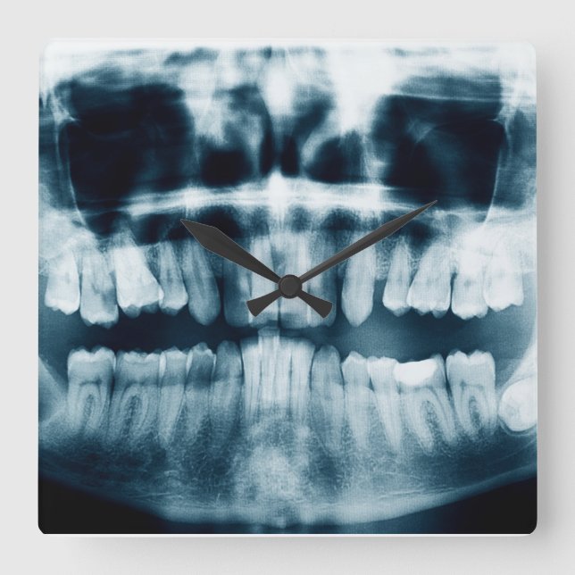 Teeth X-ray Square Wall Clock (Front)