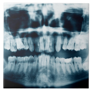 Teeth X-ray Tile