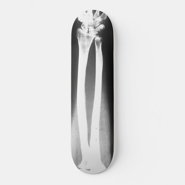 The Breaks skateboard by Bradley Boness (Front)