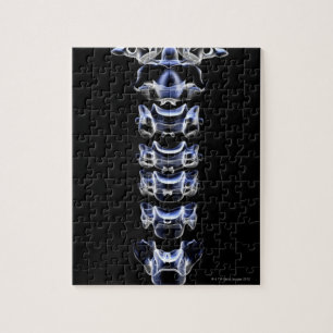 The Cervical Vertebrae Jigsaw Puzzle