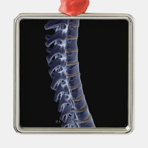 The Vertebral Column 3 Metal Tree Decoration