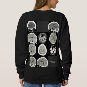 Thisiswhatdepressionlookslike_FULLCTScan Sweatshirt