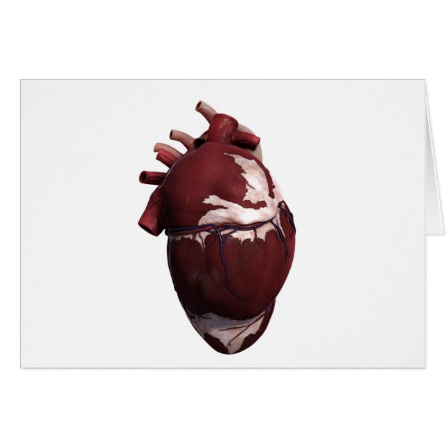 Three Dimensional View Of Human Heart, Left Side (Front Horizontal)