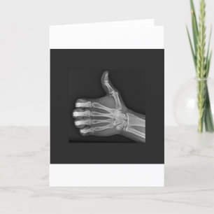 Thumbs up card