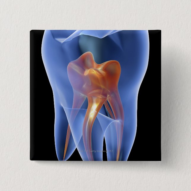Tooth, transparent cross section of a molar 15 cm square badge (Front)