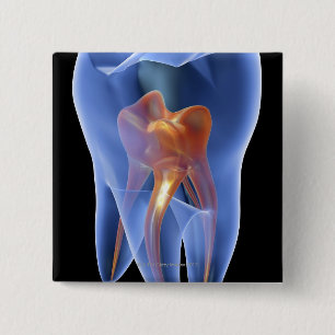 Tooth, transparent cross section of a molar 15 cm square badge