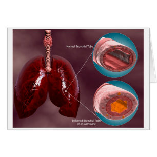 Trachea Cross-Section With Lungs