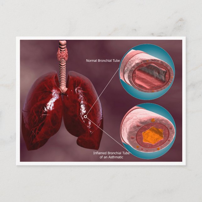 Trachea Cross-Section With Lungs Postcard (Front)