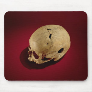 Trepanned Skull Mouse Mat